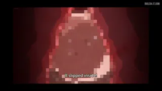 Preview at 00:07